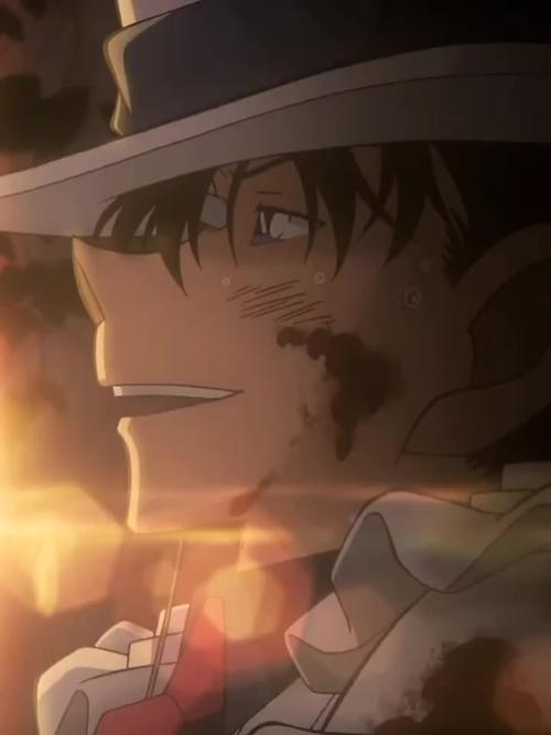 基德谈浓眉伤退：他左小腿酸痛但曾试图返场 但我们不想冒险